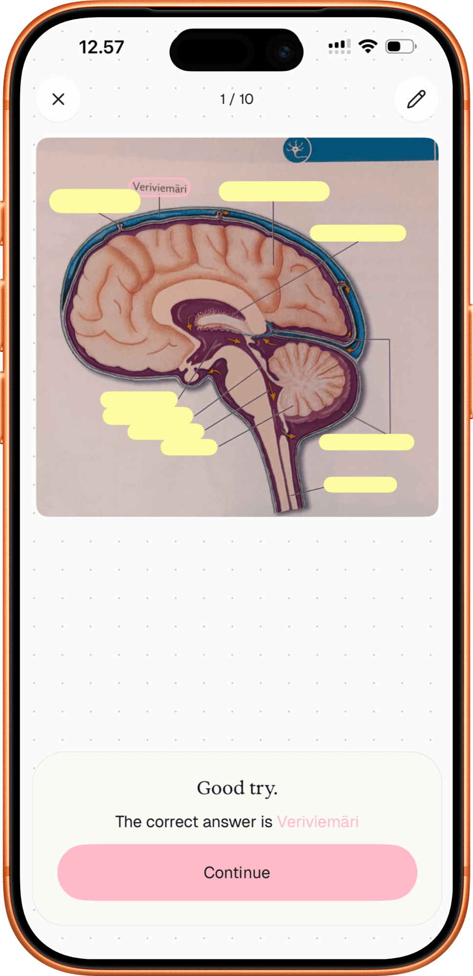 Lexie image occlusion — hide labels and test recall